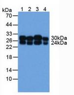 COMT Antibody in Western Blot (WB)