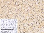 CD5 Antibody in Immunohistochemistry (Paraffin) (IHC (P))