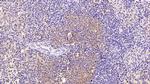CD5 Antibody in Immunohistochemistry (Paraffin) (IHC (P))