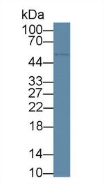 CD5 Antibody in Western Blot (WB)