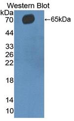 CD5 Antibody in Western Blot (WB)