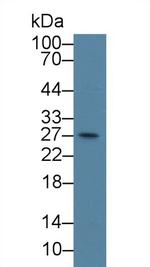 CENPH Antibody in Western Blot (WB)