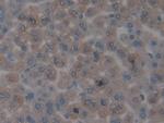 CENPH Polyclonal Antibody
