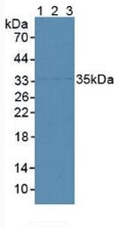 CENPH Antibody in Western Blot (WB)