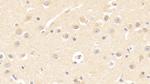 TCP-1 beta Antibody in Immunohistochemistry (Paraffin) (IHC (P))