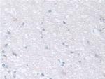 TCP-1 beta Antibody in Immunohistochemistry (Paraffin) (IHC (P))