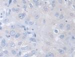 TCP-1 beta Antibody in Immunohistochemistry (Paraffin) (IHC (P))