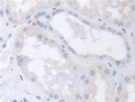 TCP-1 beta Antibody in Immunohistochemistry (Paraffin) (IHC (P))