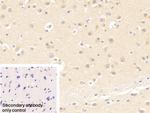 TCP-1 beta Antibody in Immunohistochemistry (Paraffin) (IHC (P))