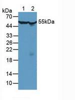 TCP-1 beta Antibody in Western Blot (WB)