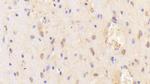 CHN2 Polyclonal Antibody