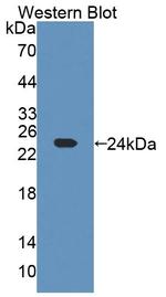 CHN2 Antibody in Western Blot (WB)