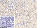 CHRDL1 Polyclonal Antibody