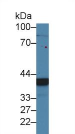 CHRDL1 Antibody in Western Blot (WB)