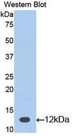 CGA Antibody in Western Blot (WB)