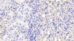 CLTA Polyclonal Antibody