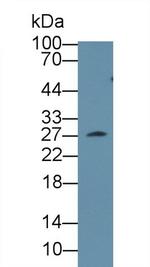 CLTA Antibody in Western Blot (WB)