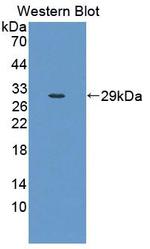 CLTA Antibody in Western Blot (WB)