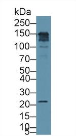 CD164 Antibody in Western Blot (WB)