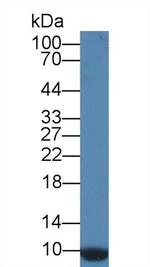 CD164 Antibody in Western Blot (WB)