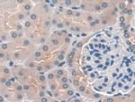 DC-SIGN Antibody in Immunohistochemistry (Paraffin) (IHC (P))