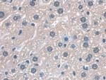 DC-SIGN Antibody in Immunohistochemistry (Paraffin) (IHC (P))