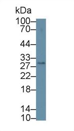 DC-SIGN Antibody in Western Blot (WB)