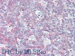 CD229 Antibody in Immunohistochemistry (Paraffin) (IHC (P))