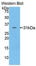 CD229 Antibody in Western Blot (WB)