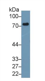 CD229 Antibody in Western Blot (WB)