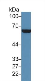 CD36 Antibody in Western Blot (WB)