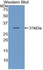 CD36 Antibody in Western Blot (WB)