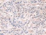 COTL1 Antibody in Immunohistochemistry (Paraffin) (IHC (P))