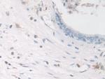 COTL1 Antibody in Immunohistochemistry (Paraffin) (IHC (P))