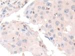 COTL1 Antibody in Immunohistochemistry (Paraffin) (IHC (P))