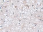 COTL1 Antibody in Immunohistochemistry (Paraffin) (IHC (P))