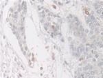COTL1 Antibody in Immunohistochemistry (Paraffin) (IHC (P))