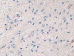 Factor V Antibody in Immunohistochemistry (Paraffin) (IHC (P))