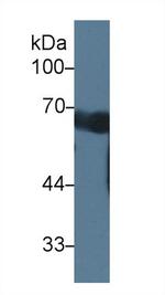 CCDC60 Antibody in Western Blot (WB)