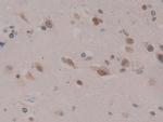 CIRBP Antibody in Immunohistochemistry (Paraffin) (IHC (P))