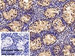 CIRBP Antibody in Immunohistochemistry (Paraffin) (IHC (P))