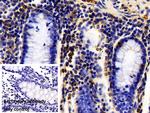 CIRBP Antibody in Immunohistochemistry (Paraffin) (IHC (P))