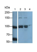 Collagen III Polyclonal Antibody