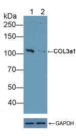 Collagen III Antibody in Western Blot (WB)