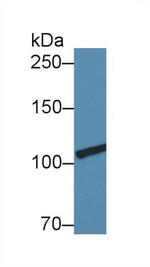 Collagen III Antibody in Western Blot (WB)