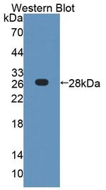 COL4A4 Antibody in Western Blot (WB)