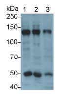 COL4A5 Antibody in Western Blot (WB)