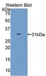 COL4A5 Antibody in Western Blot (WB)