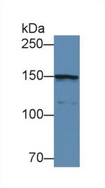 COL4A5 Antibody in Western Blot (WB)