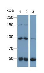 Complement C4b Antibody in Western Blot (WB)